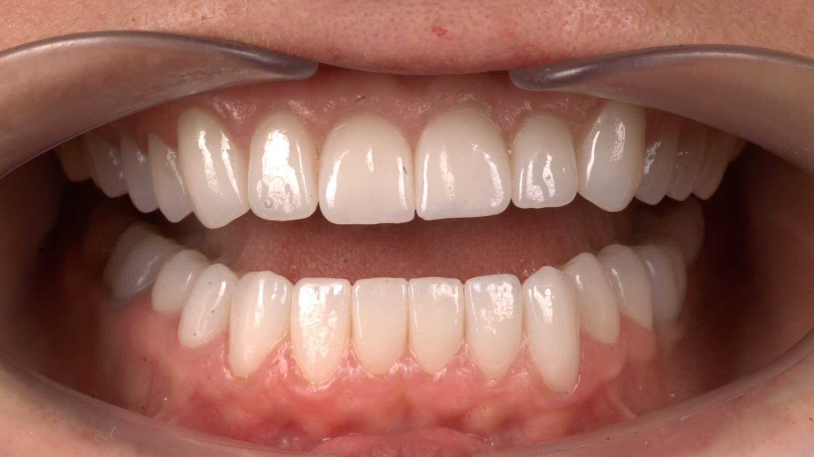 Case Study | Mariana