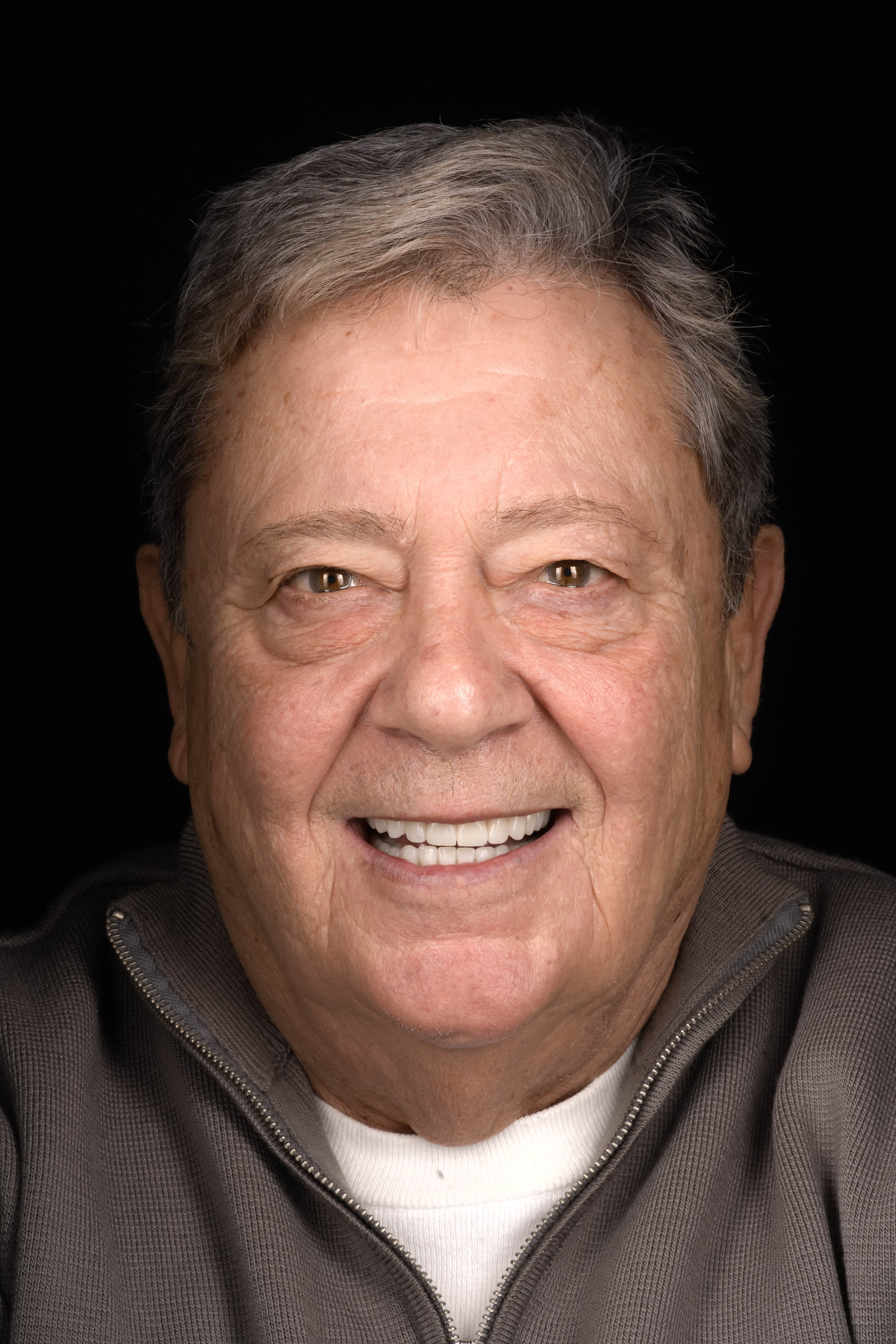 Full-Mouth Rehabilitation with Crowns and Implants